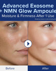 EXO-V PLUS AMPOULEN