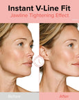 id FACE FIT MINUS BAND V2 (1 Stk.)