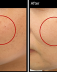 MIRACLETOX Camellia aufhellende Ampulle