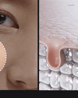 ID.AZ FACE FIT PLASTER MASK EX (4 Stk.)