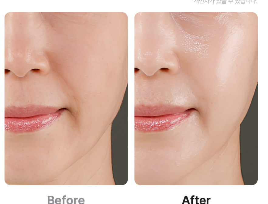 AGE-R BOOSTER PRO EX ROSA