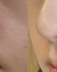 CELLOLOGY PURPLE CARROT PORE AMPULLE