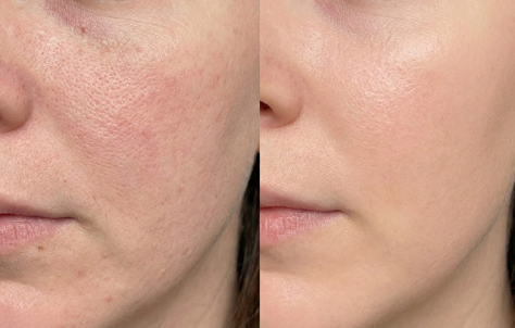 DDALMOMDE CHAGA CICA GLOW EXOSOME CREME