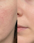 DDALMOMDE CHAGA CICA GLOW EXOSOME CREME
