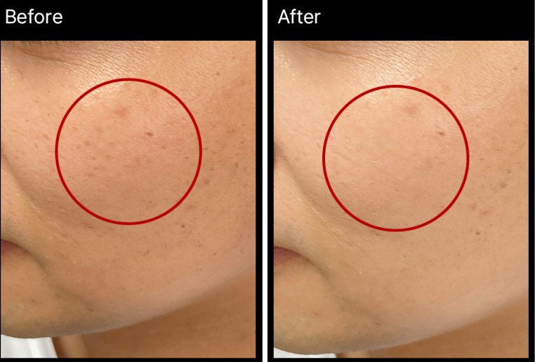 MIRACLETOX Camellia aufhellende Ampulle