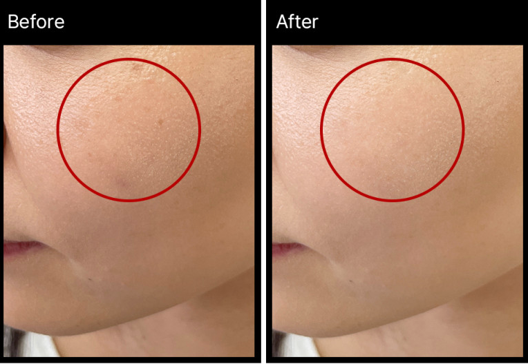 MIRACLETOX Camellia aufhellende Ampulle
