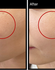 MIRACLETOX Camellia aufhellende Ampulle