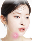 ACROPASS JOLLY FILLY LIP PLUMPER PATCH (1ea)