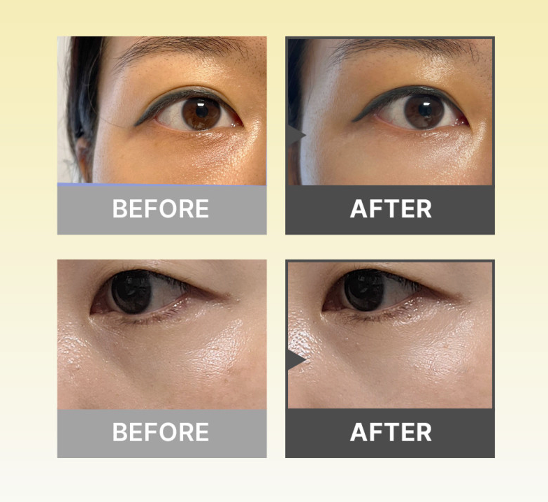 Bakuchiol Dual Vita Eyecream
