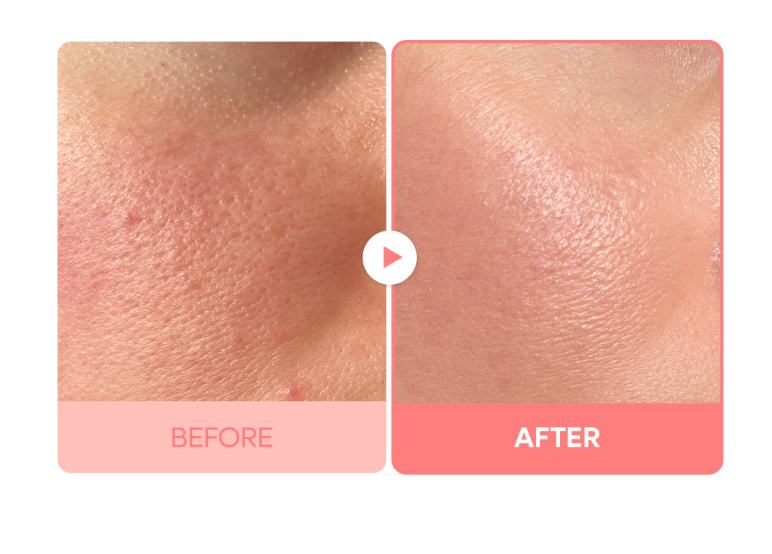 Dr.Melaxin Cactox Pore Relief Dual Capsule Cream 65g