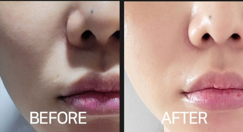 CELLVIO DOLDORI ELECDERMA ROLL MASKE (1 Stk.)