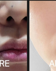 CELLVIO DOLDORI ELECDERMA ROLL MASKE (1 Stk.)