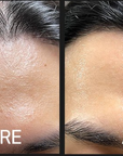 CELLVIO DOLDORI ELECDERMA ROLL MASKE (1 Stk.)