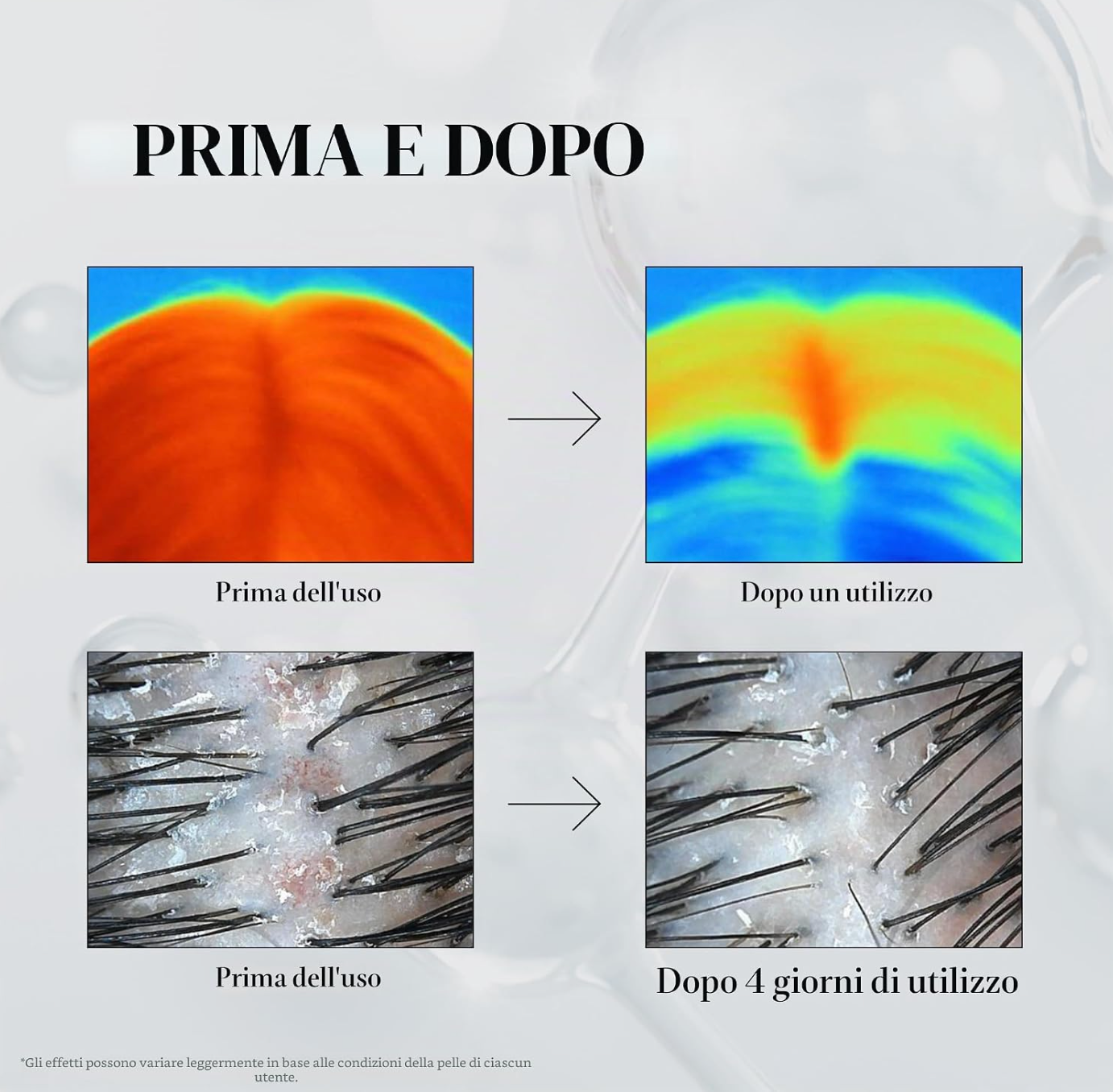 VT PDRN REEDLE SHOT HAIR AMPULLE 100dl