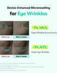 VT PDRN Reedle Shot Eye Lifter Creme