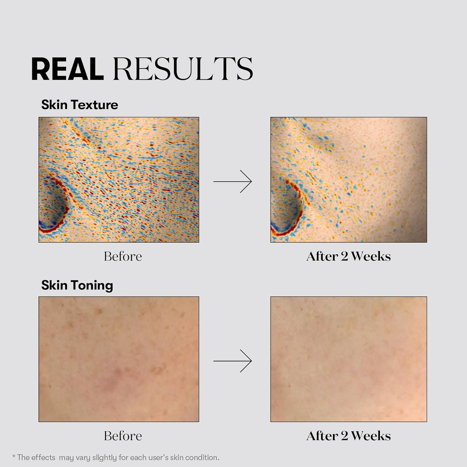 VT TX-TONING CREAM