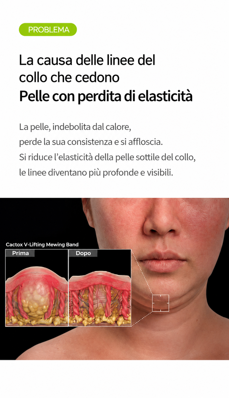 Dr.Melaxin CACTOX COOLING V-UP MASKE (4 St.)