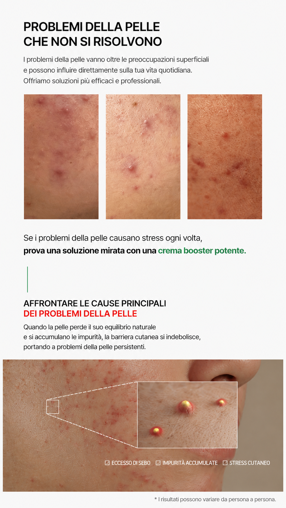 VEMONTES AXCNE BOOSTER CREAM 50ml