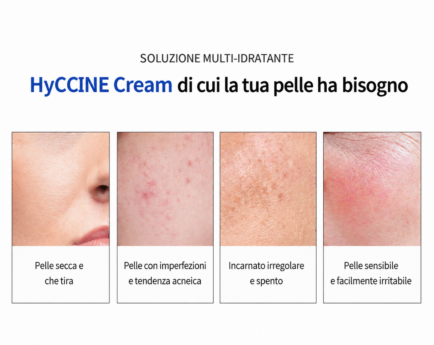 VEMONTES HYCCINE CREAM 100ml