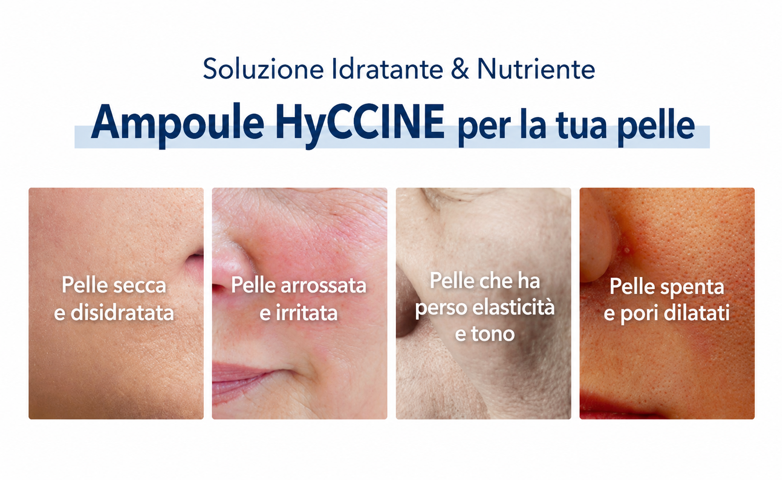 VEMONTES HYCCINE AMPOULE KIT