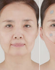 idPLACOSMETICS FACE FIT PLUS PATCH V3 (4 Stück)